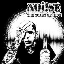 Noi!se "The Scars We Hide" LP